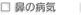 大阪府高槻市紺屋町9-18さつきビル１Fの新京町やまもと耳鼻咽喉科／鼻の病気